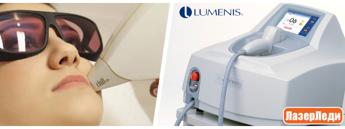 эпиляция лазером, лазерная эпиляция, laser hair removal what is it, lumenis lightsheer et, эффективность лазерной эпиляции, диодный лазер ЭПИЛЯЦИЯ ЛАЗЕРОМ - ДИОДНЫМ ЛАЗЕРОМ Lumenis LightSheer ET