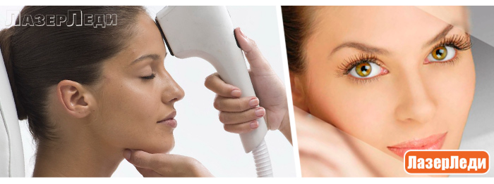 ФОТООМОЛОЖЕНИЕ - ЛАЗЕРНОЕ ОМОЛОЖЕНИЕ КОЖИ фотоомоложение, лазерное омоложение кожи, laser facial rejuvenation, beauty, лифтинг кожи, радиоволновой лифтинг, лазерледи, ультразвуковой пилинг, контурная коррекция